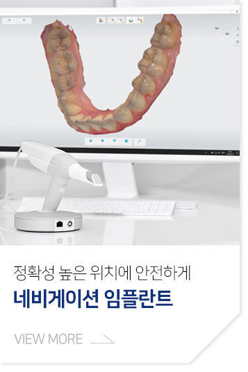 정확한-위치에-안전하게-네비게이션-임플란트