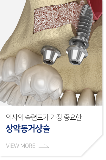 의사의-숙련도가-가장-중요한-상악동거상술