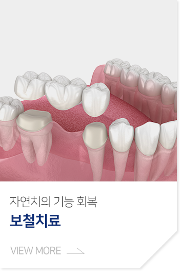 자연치의-기능-회복-보철치료