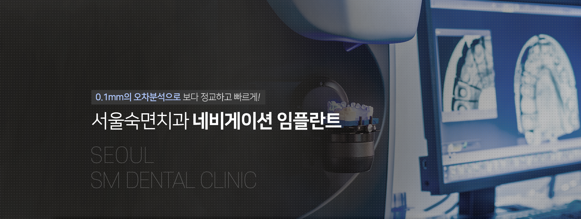 0.1mm의-오차분석으로-보다-정교하고-빠르게-서울숙면치과-네비게이션-임플란트