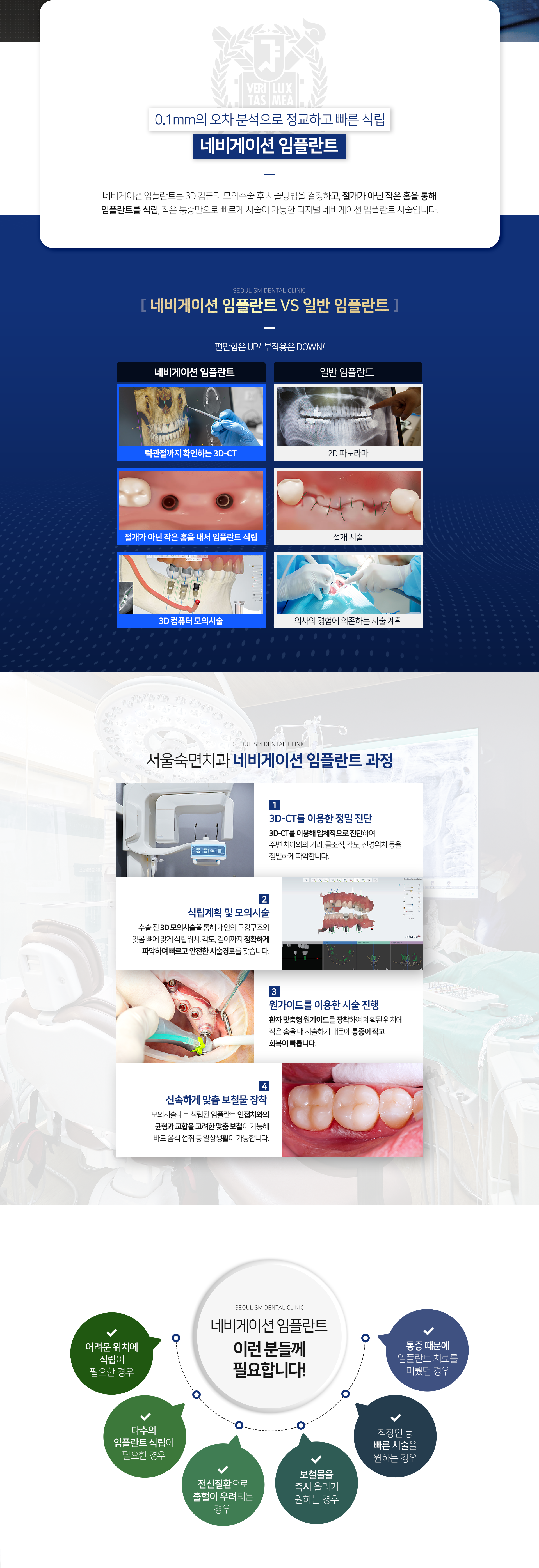 네비게이션-임플란트는-3D-컴퓨터-모의-수술-후-시술-방법을-결정하고-절개가-아닌-작은-홈을-통해-임플란트를-식립하여-적은-통증만으로-빠르게-시술이-가능한-디지털-네비게이션-임플란트-시술입니다-네비게이션-임플란트-과정-1단계-3D_CT를-이용한-정밀-진단-2단계-식립-계획-및-모의-시술-3단계-원가이드를-이용한-시술-진행-4단계-신속하게-맞춤-보철물-장착-이런-분들께-필요합니다-어려운-위치에-식립이-필요한-경우-다수의-임플란트-식립이-필요한-경우-전신질환으로-출혈이-우려되는-경우-보철물을-즉시-올리기-원하는-경우-직장인-등-빠른-시술을-원하는-경우-통증-때문에-임플란트-치료를-미뤘던-경우