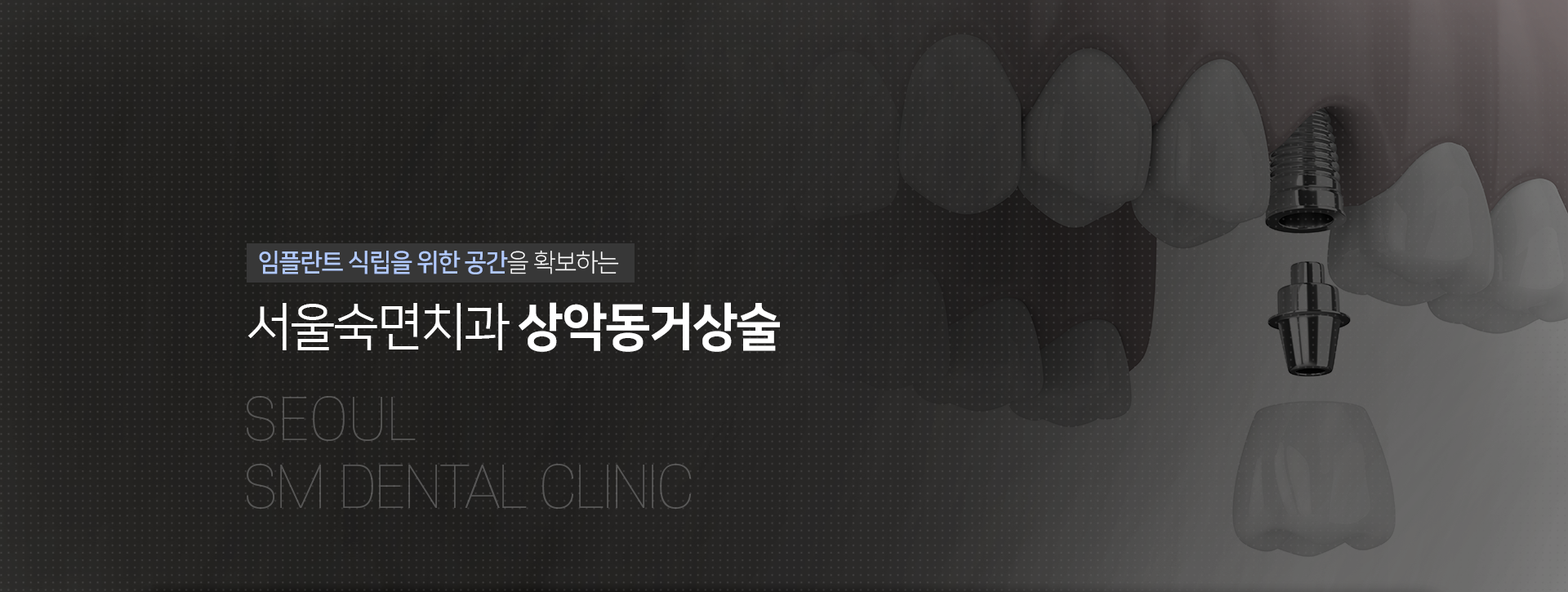 임플란트-식립을-위한-공간을-확보하는-서울숙면치과-상악동거상술