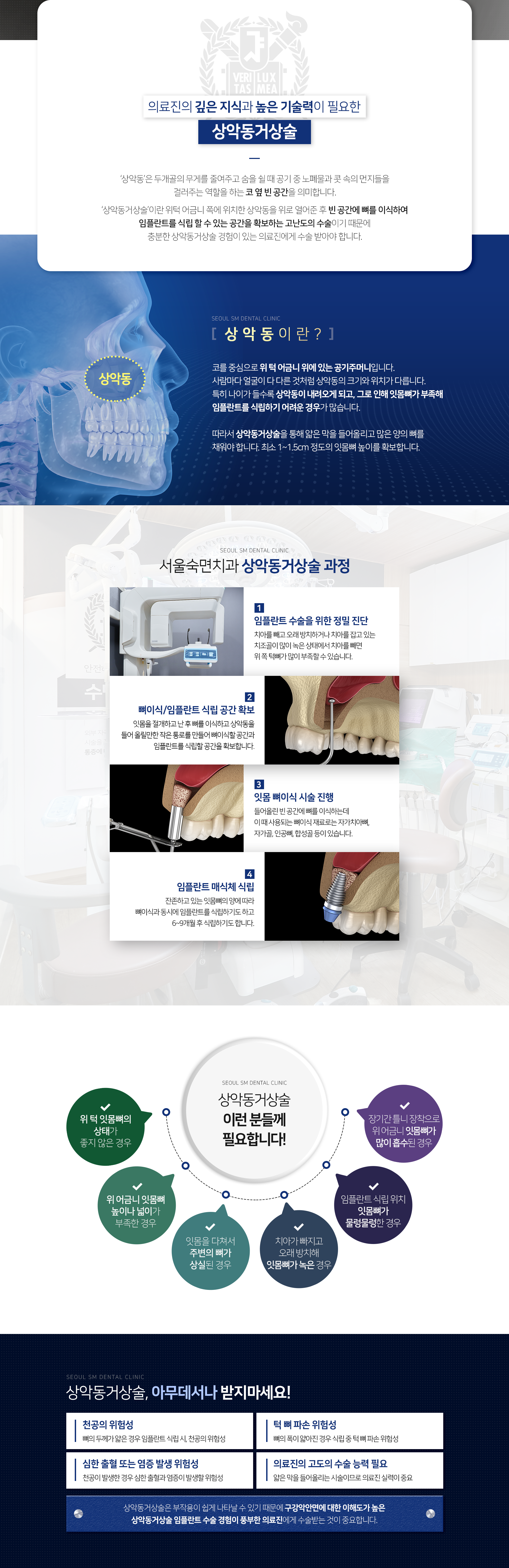 상악동거상술-과정-1단계-임플란트-수술을-위한-정밀-진단-2단계-뼈이식/임플란트-식립-공간-확보-3단계-잇몸-뼈이식-시술-진행-4단계-임플란트-매식체-식립-이런-분들께-필요합니다-위-턱-잇몸뼈의-상태가-좋지-않은-경우-위-어금니-잇몸뼈-높이나-넓이가-부족한-경우-잇몸을-다쳐서-주변의-뼈가-상실된-경우-치아가-빠지고-오래-방치해-잇몸뼈가-녹은-경우-임플란트-식립-위치-잇몸-뼈가-물렁물렁한-경우-장기간-틀니-장착으로-위-어금니-잇몸뼈가-많이-흡수된-경우-상악동거상술-아무-데서나-받지-마세요-뼈의-두께가-얇은-경우-임플란트-식립-시-천공의-위험성-뼈의-폭이-얇아진-경우-식립-중-턱뼈-파손-위험성-천공이-발생한-경우-심한-출혈과-염증이-발생할-위험성-얇은-막을-들어-올리는-시술이므로-의료진-실력이-중요