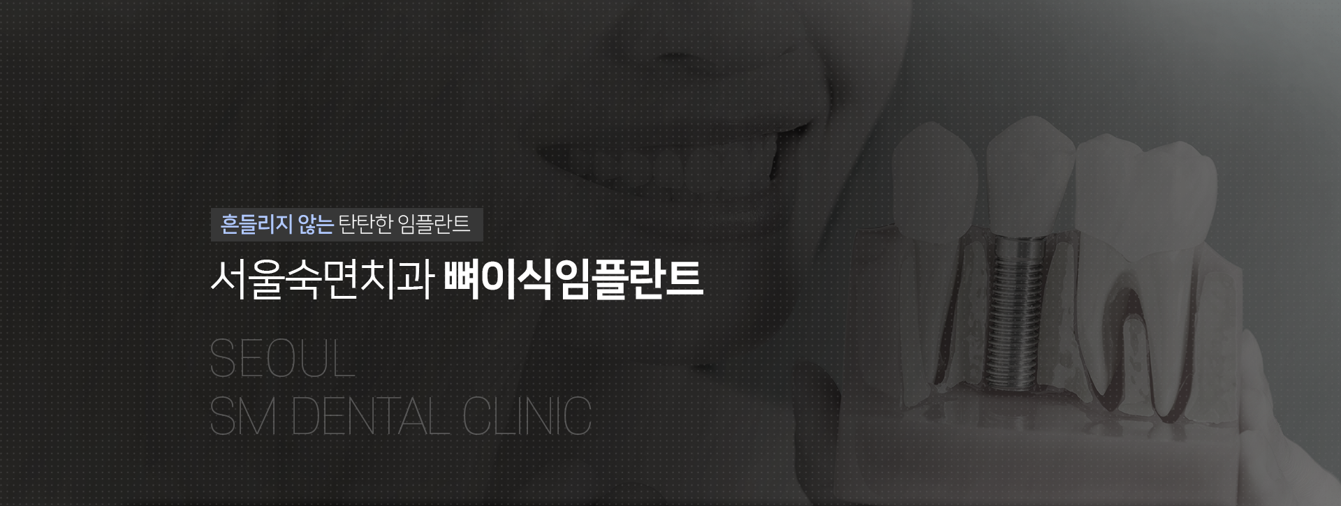 흔들리지-않는-탄탄한-임플란트-서울숙면치과-뼈이식-임플란트