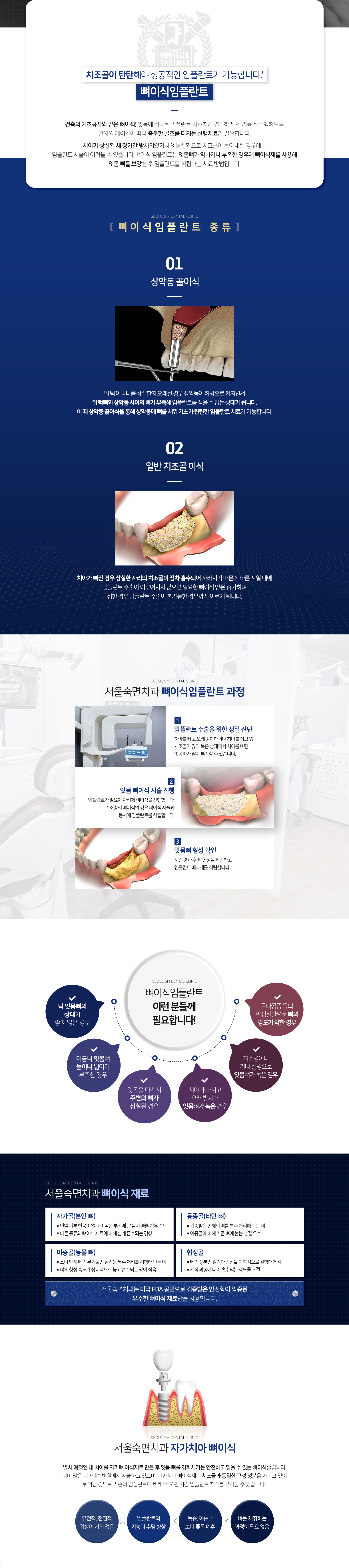 이런-분들께-필요합니다-턱-잇몸뼈의-상태가-좋지-않은-경우-어금니-잇몸뼈-높이나-넓이가-부족한-경우-잇몸을-다쳐서-주변의-뼈가-상실된-경우-치아가-빠지고-오래-방치해-잇몸뼈가-녹은-경우-치주염이나-기타-질병으로-잇몸-뼈가-녹은-경우-골다공증-등의-만성질환으로-뼈의-강도가-약한-경우-뼈이식-재료-종류1-자가골_본인-뼈-면역-거부-반응-없음-빠른-치유-속도-타-뼈이식-재료에-비해-쉽게-흡수되는-경향-종류2-동종골_타인-뼈-기증받은-인체의-뼈를-특수-처리해-만든-뼈-이종골에-비해-기존-뼈에-붙는-성질-우수-종류3-이종골_동물-뼈-소나-돼지-뼈의-무기물만-남기는-특수-처리를-시행해-만든-뼈-뼈의-형성-속도가-상대적으로-늦고-흡수되는-양이-적음-종류4-합성골-뼈의-성분인-칼슘과-인산을-화학적으로-결합해-제작-제작-과정에-따라-흡수되는-정도를-조절-자가-치아-뼈이식-발치-예정인-내-치아를-자가뼈-이식재로-만든-후-잇몸-뼈를-강화시키는-안전하고-믿을-수-있는-뼈이식술