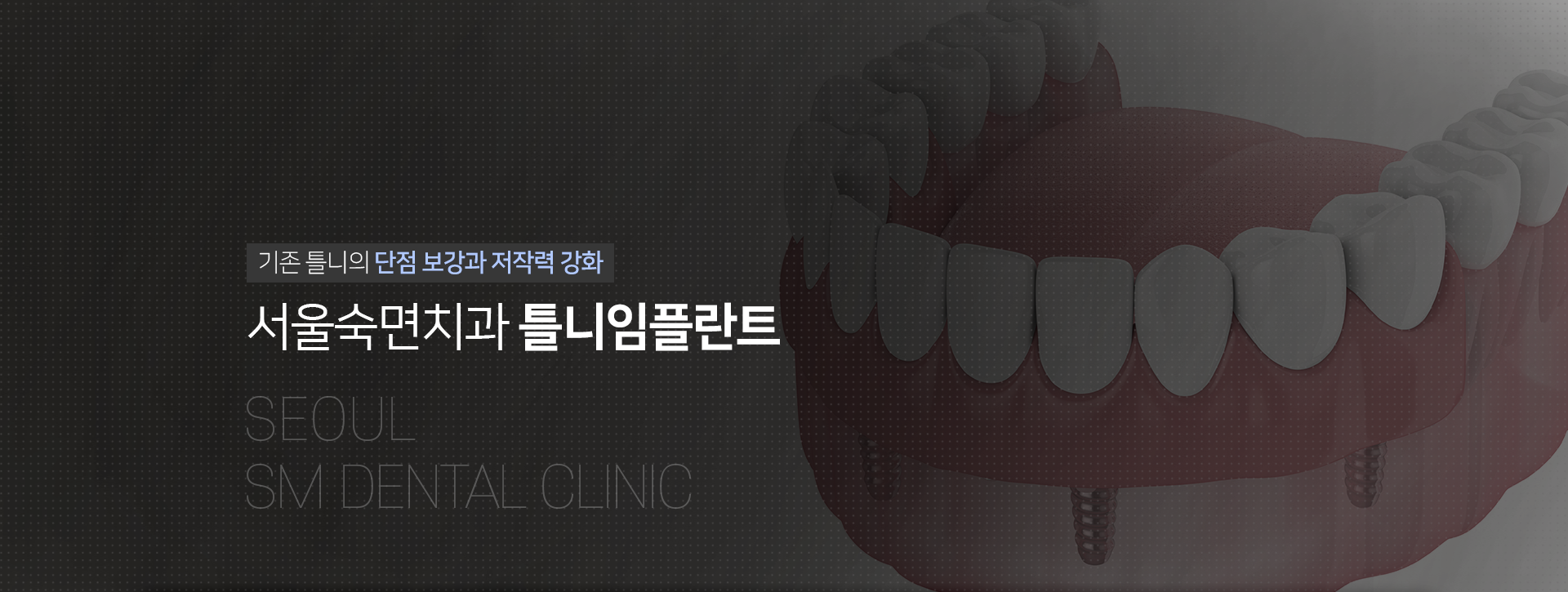기존-틀니의-단점-보강과-저작력-강화-서울숙면치과-틀니-임플란트