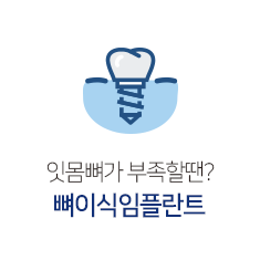 뼈이식임플란트