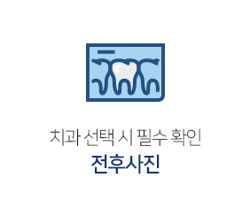 전후사진